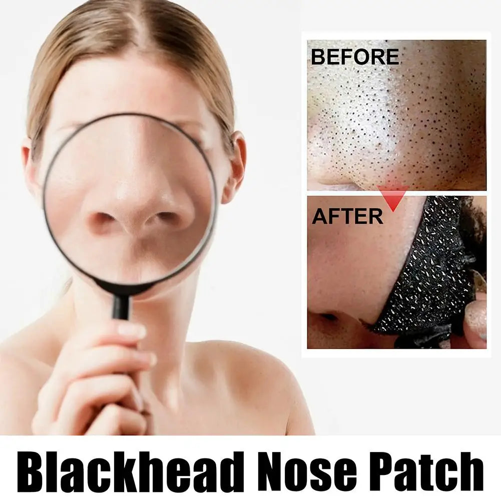 10pcs/Box Blackhead Remover Nose Strips Nasal Patch Deep Cleaning Shrink Pores Acne Treatment Nose Blackhead Mask Strip Skincare Oasis Select