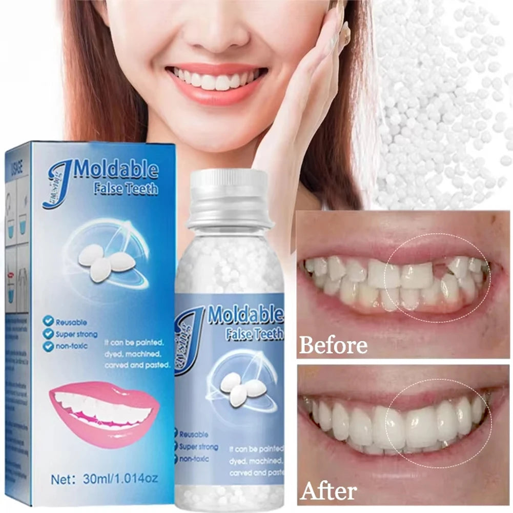 Temporary Tooth Repair Kit – DIY Moldable Filling & Gap Fix