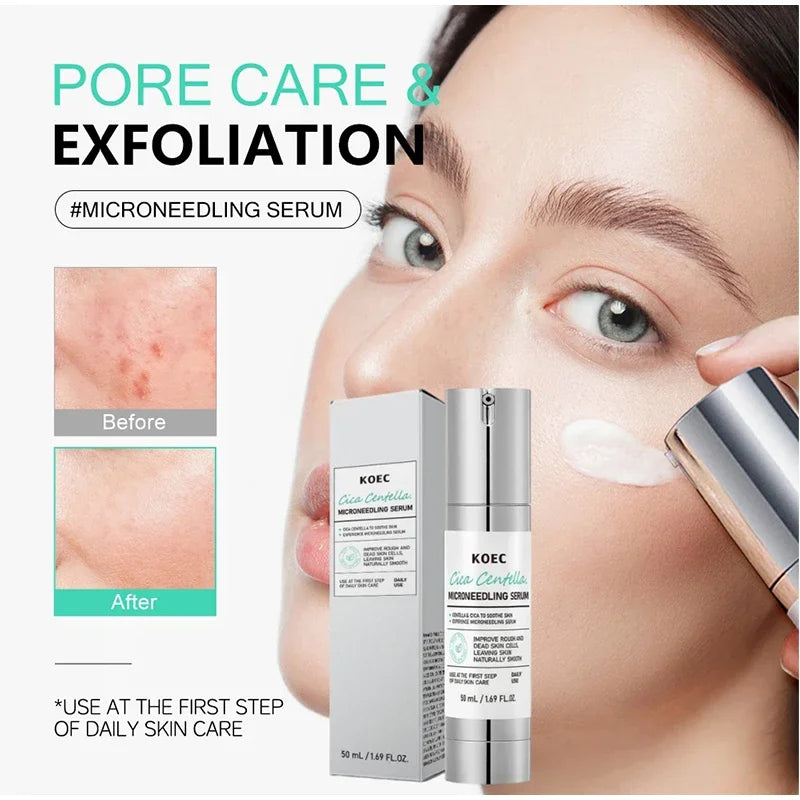 Centella Asiatica Microneedle Serum Deep Hydration Soothing Dragon Blood Serum Firm Brighten Repairing Facial Essence Oasis Select