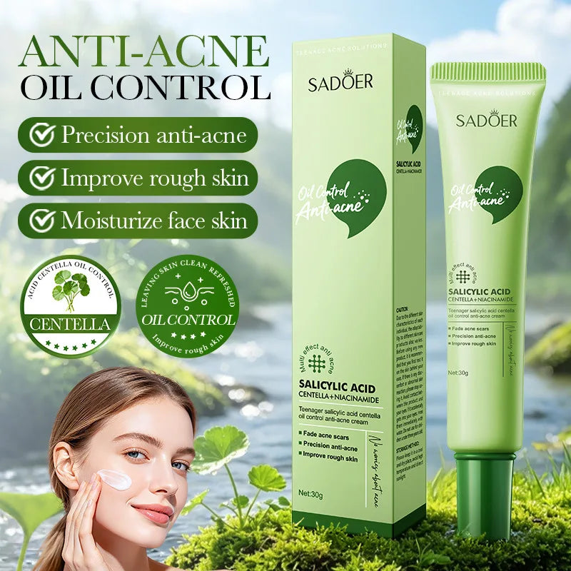 SADOER Salicylic Acid Face Cream – Oil Control & Clear Pores Acne Face Cream Oasis Select