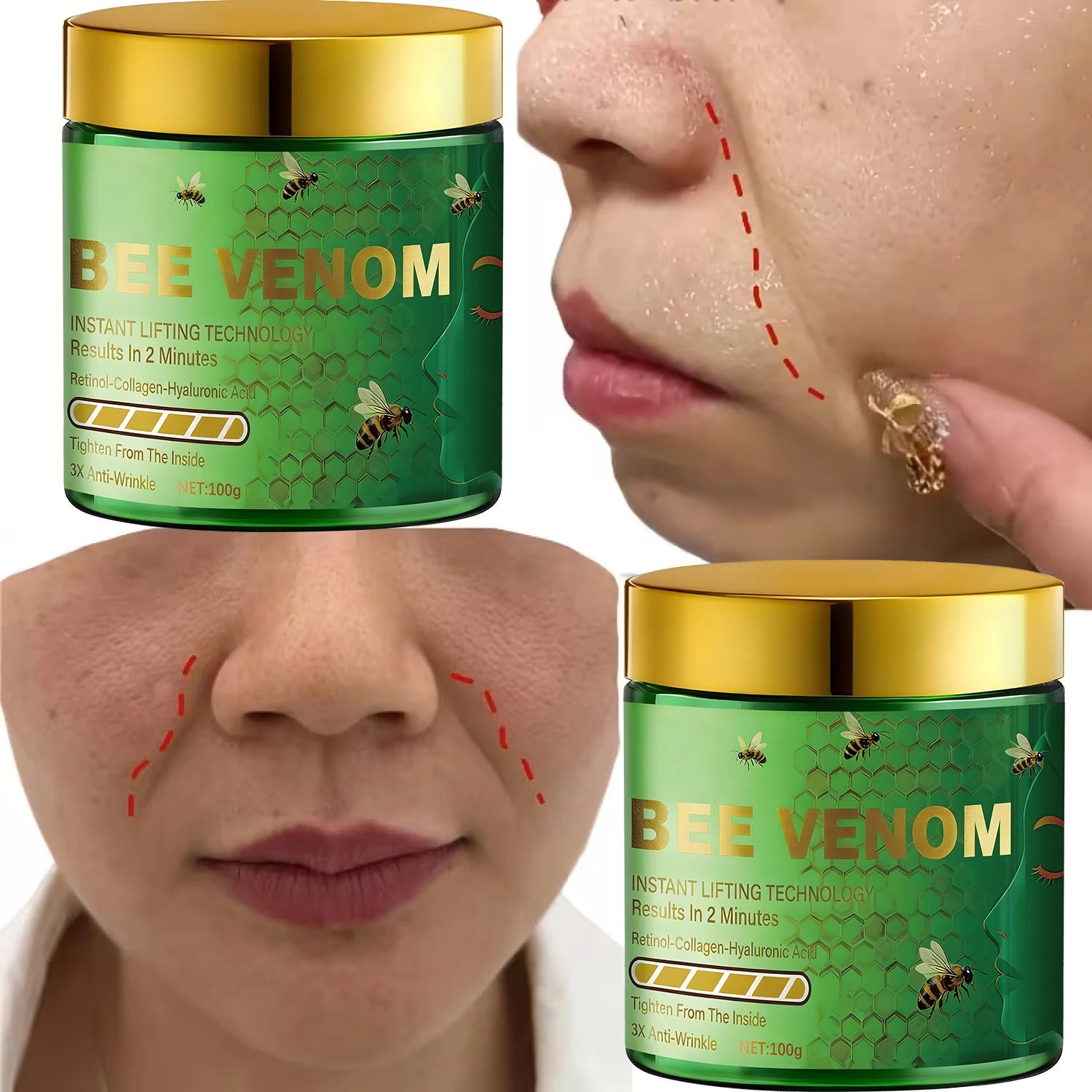 Bee Venom Lifting Cream – Anti-Wrinkle Retinol & Collagen Anti-Aging Face Cream Oasis Select