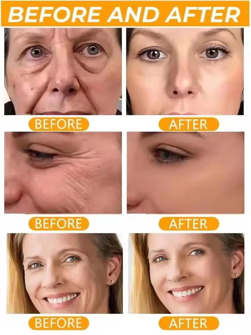 Instant Collagen Protein Threads Lifting Firming Absorbable Face Filler Anti-aging Deep Repair Fade Fine Lines Korean Skincare Oasis Select