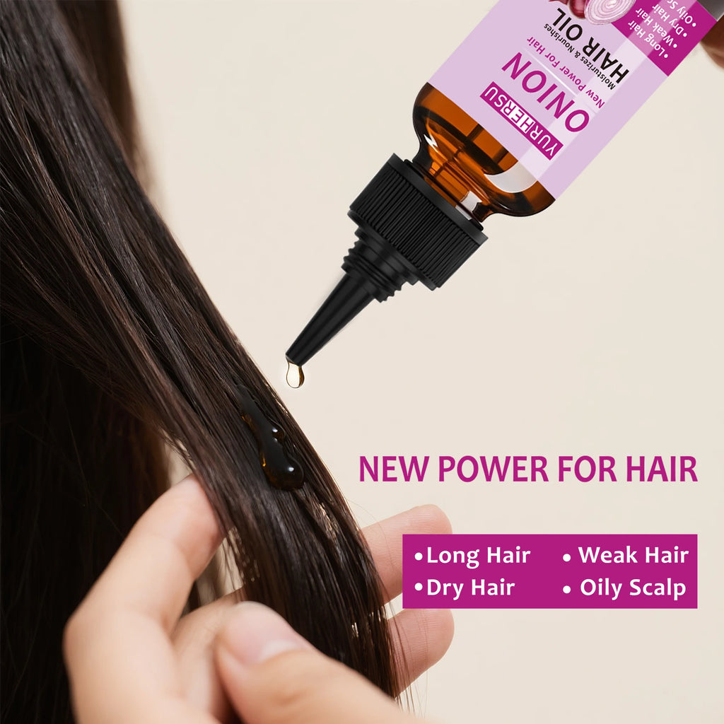 YURHERSU Onion Hair Oil – Pure Natural Hair Growth Treatment Hair Growth Oil Oasis Select