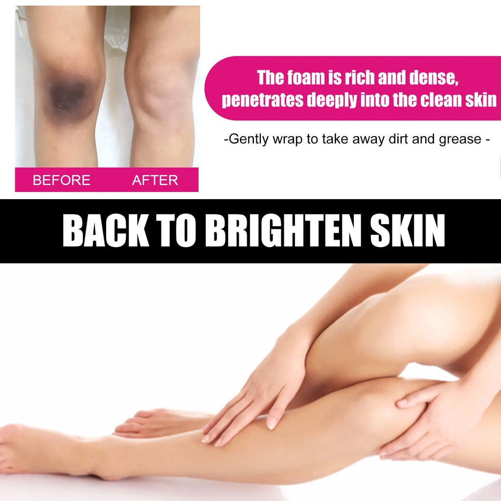 EELHOE Body Whitening Exfoliating Soap – Dark Spot Remover Body Whitening Soap Oasis Select