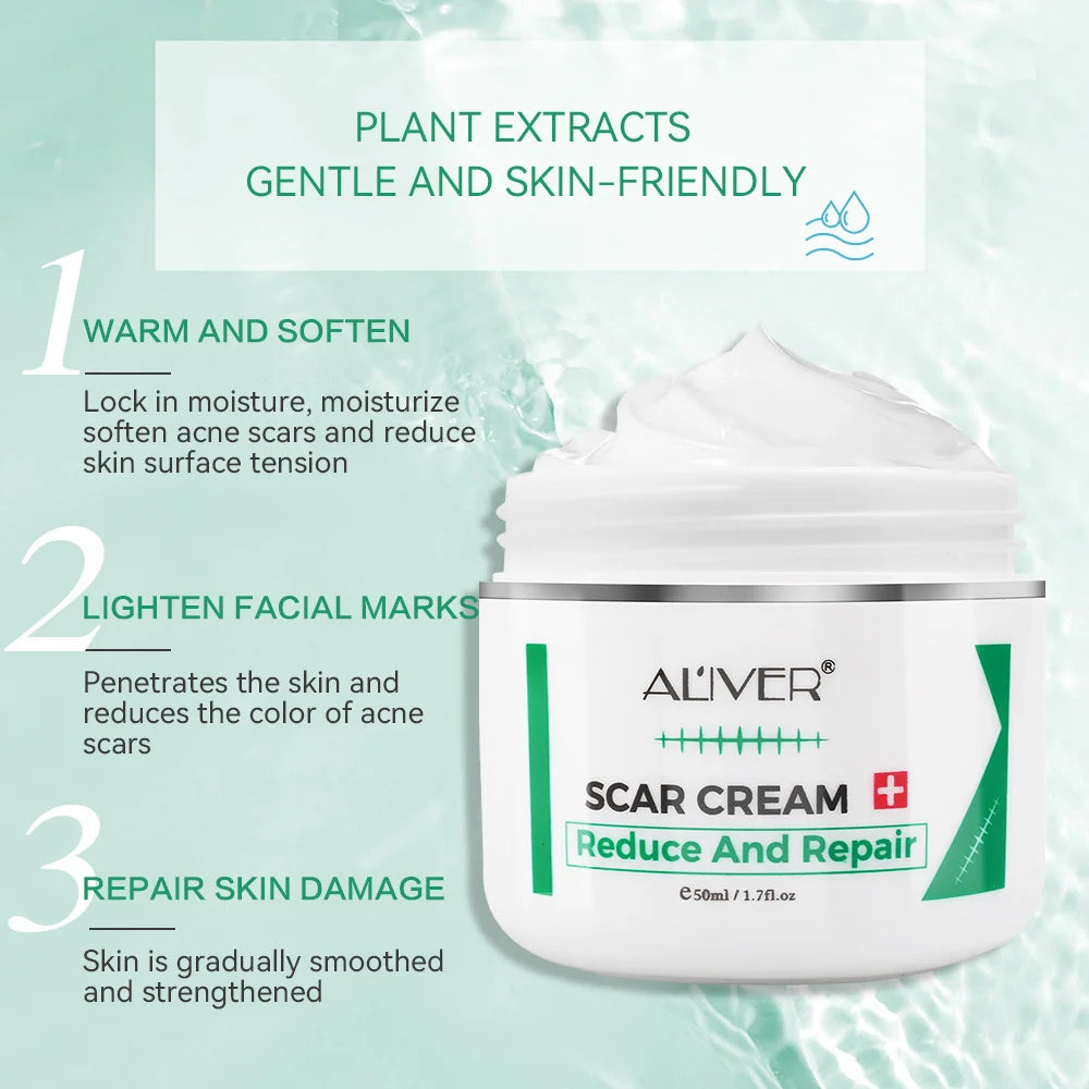 ALVER Acne Scar Stretch Marks Remover Cream Skin Repair Acne Black Dots Spots Acne Treatment Blackhead Bleaching Cream 50ml Oasis Select