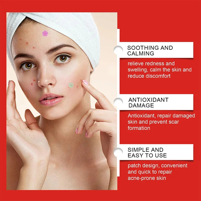 240pcs Salicylic Acid Acne PatchesStar Pimple Patch Acne Colorful Invisible Acne Removal Skin Care Stickers Concealer Face Spot Oasis Select