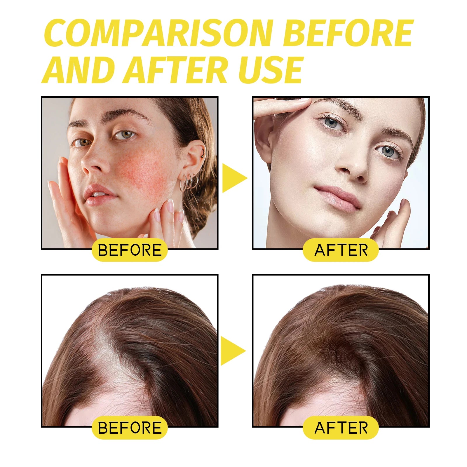 Eelhoe Hair Growth Essential Oil – Thinning & Baldness