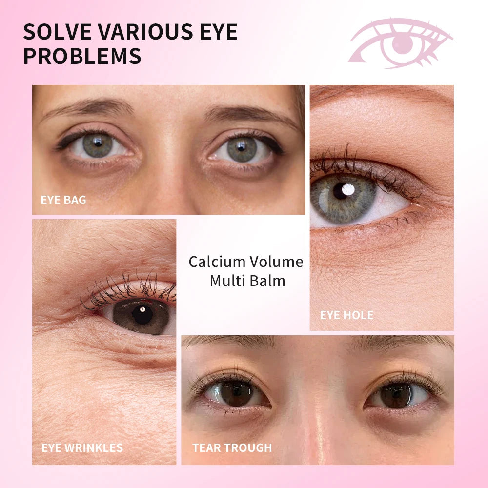 Calcium Collagen Vitamin D Eye Stick Balm Tightens Skin Care Anti Aging Anti Dark Circle Reduces Eye Bags Wrinkles Tear Trough Oasis Select