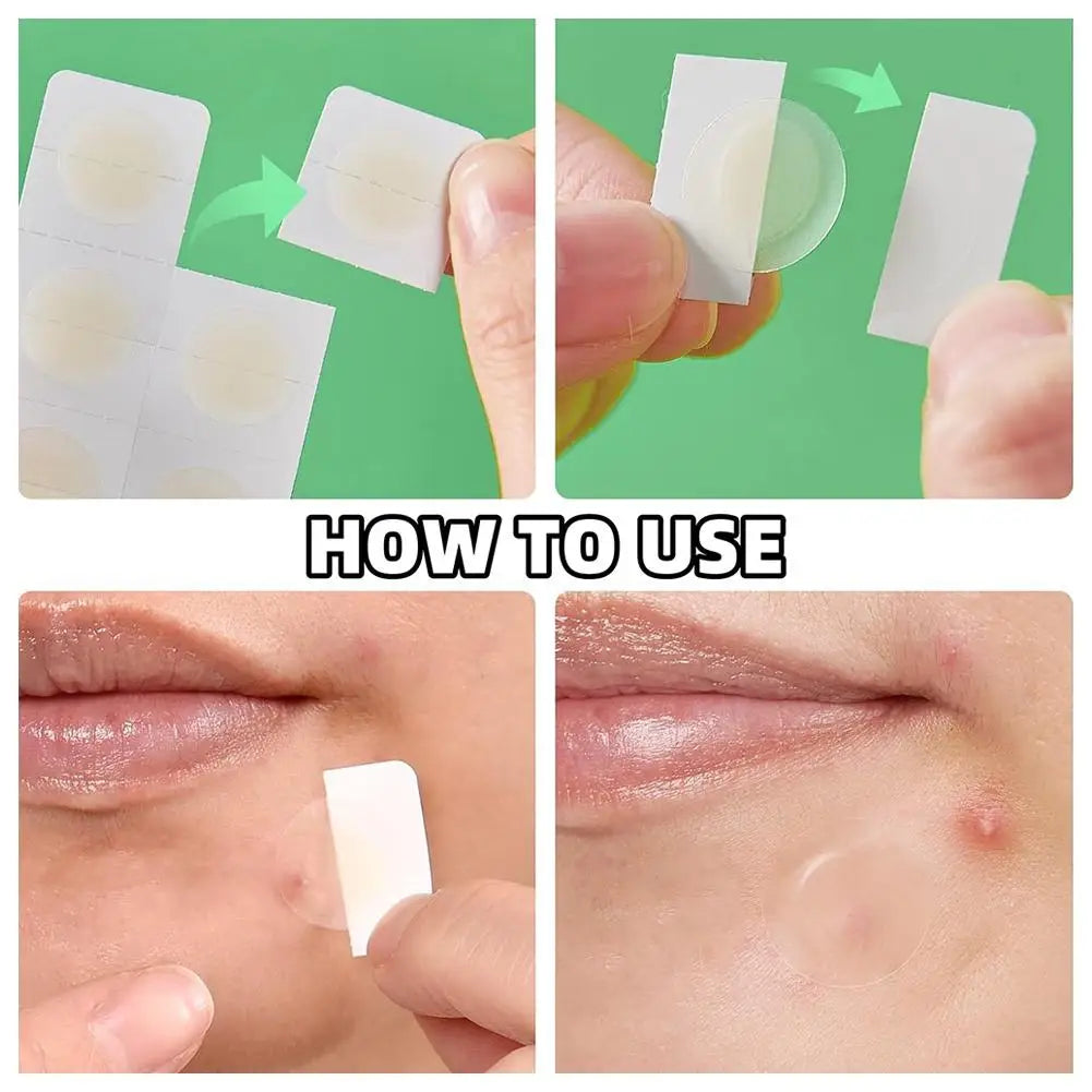 2 Packs Micro Needle Pimple Patch- Hydrocolloid Micropoint Pimple Patch For Acne Pimples Overnight, Invisible Acne Cover Patches Oasis Select