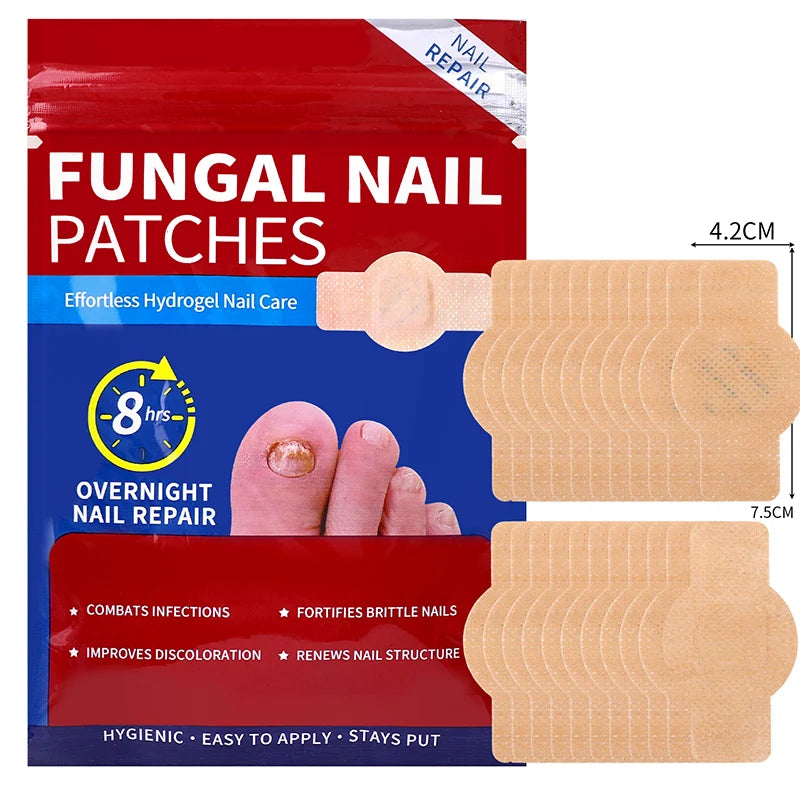 Nail Repair Patches – Toenail Care & Ingrown Correction Stickers Nail Care Patch Oasis Select 1 pack-21pcs