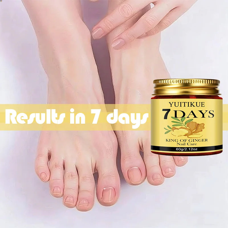 YUITIKUE Ginger King Nail Care Cream – 7-Day Results, 60g