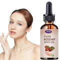Pure Rosehip Seed Oil Face Serum – Moisturizing 5–50ml