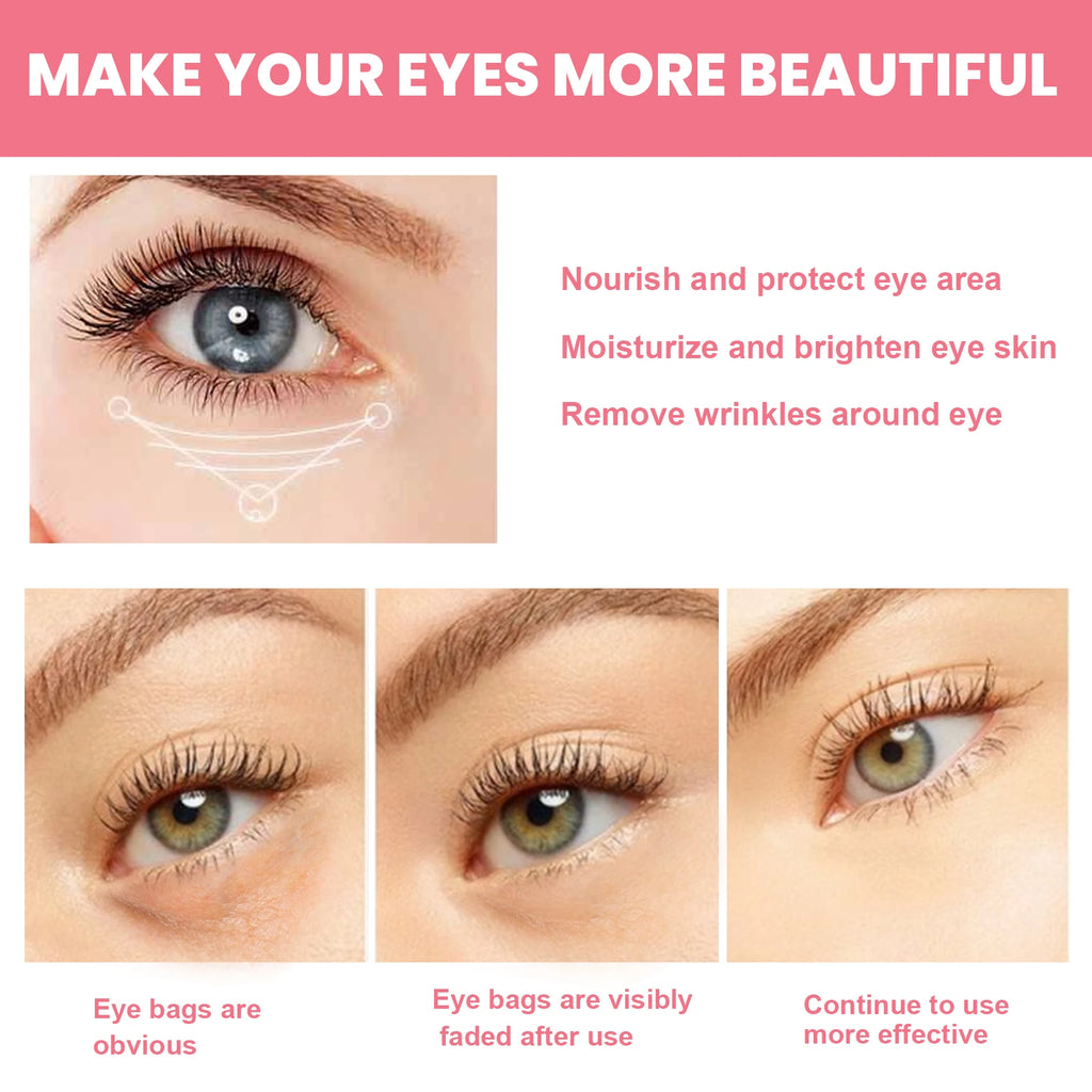 Women Extra Renewing Rosehip Eye Balm Face Lifting Moisturizing Balm Stick Fine Lines Removal Hyaluronic around the Eye Care15ml Oasis Select