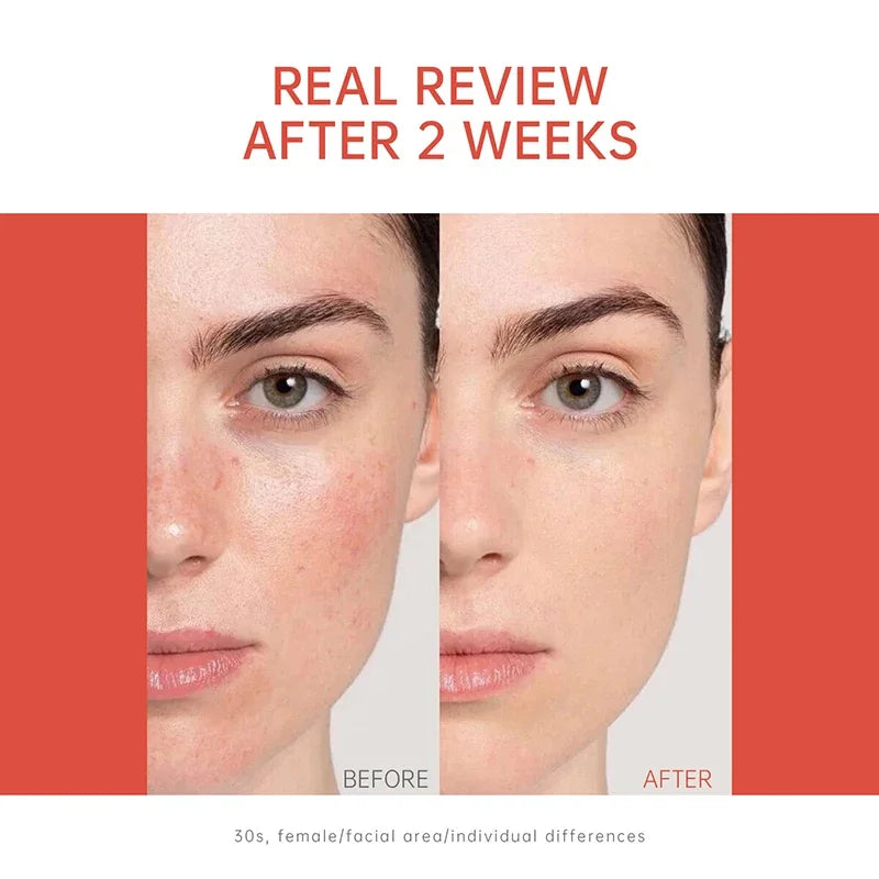 PDRN Salmon DNA Serum Ampoule – Brighten, Firm & Hydrate