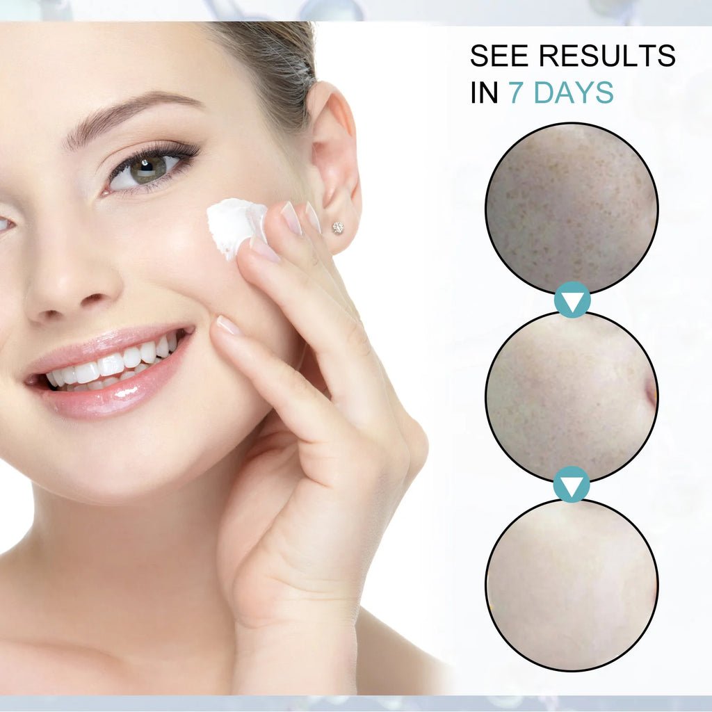 Eelhoe Dark Spot Corrector Cream – Niacinamide & Retinol 30g Dark Spot Corrector Oasis Select