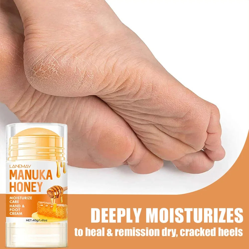 Ultra-Hydrating Beeswax Foot Cream Shea Butter Coconut Oil for Softening Dry Cracked Feet Gentle Exfoliation Daily Foot Care Oasis Select