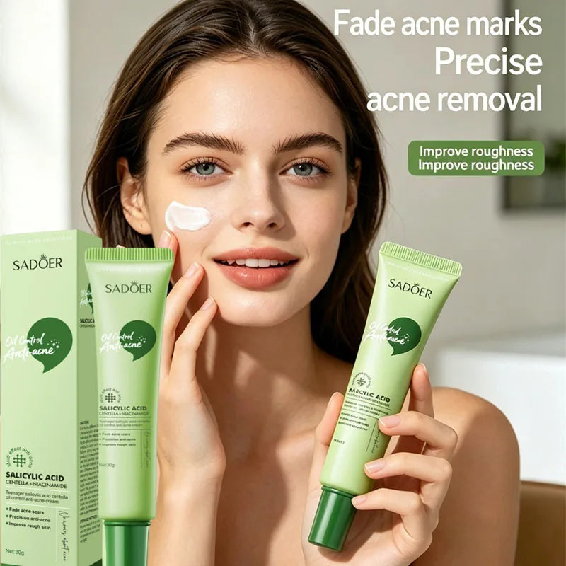 SADOER Salicylic Acid Face Cream – Oil Control & Clear Pores Acne Face Cream Oasis Select