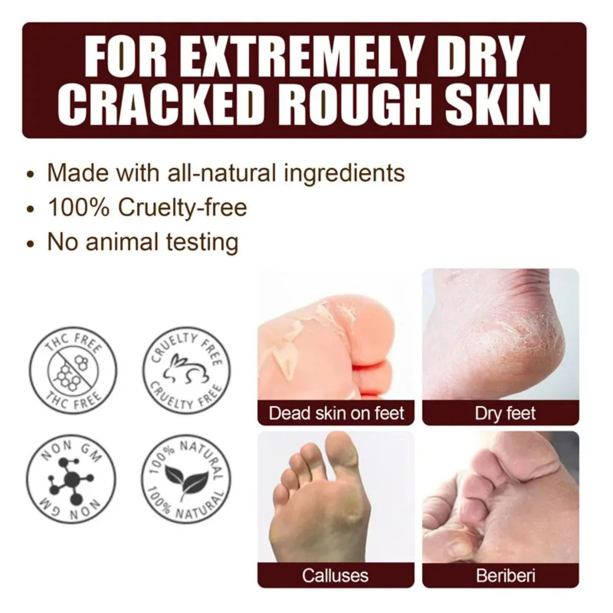 Anti Beriberi Spray Essential Oils Essence Odor Destroy Agent Care Products Feet Deodorant Spray Oasis Select