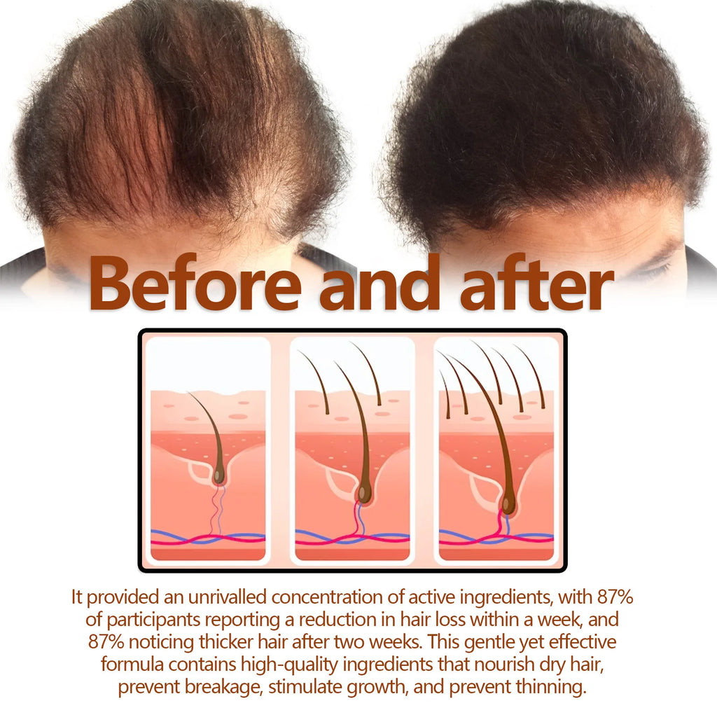 EELHOE Hair Growth Shampoo – Anti-Hair Loss & Scalp Repair Hair Growth Shampoo Oasis Select
