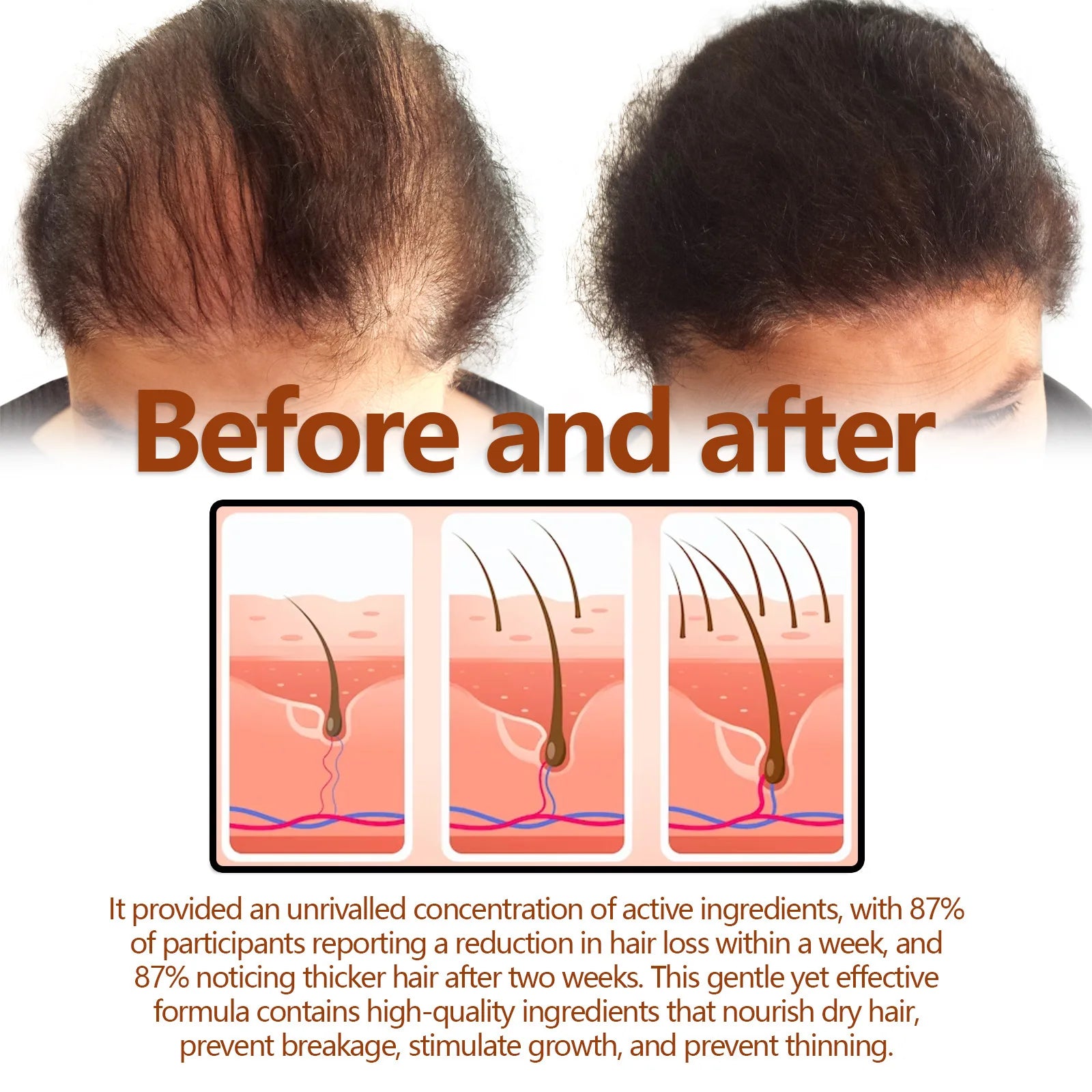 EELHOE Hair Growth Shampoo – Anti-Hair Loss & Scalp Repair Hair Growth Shampoo Oasis Select