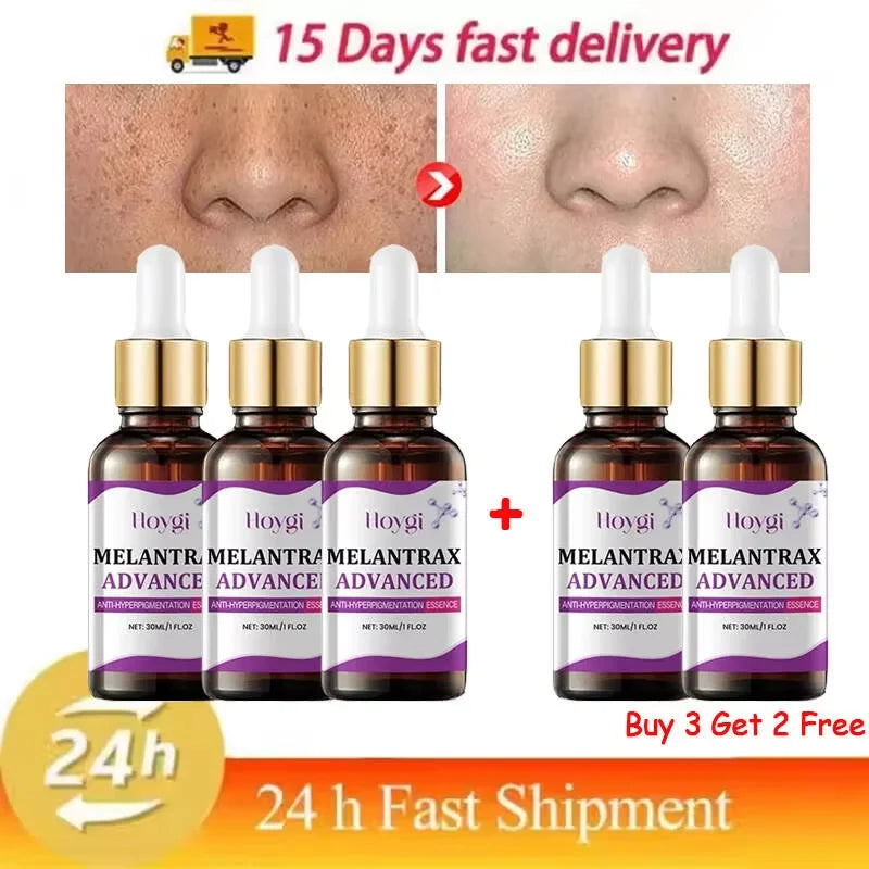 Hoygi Niacinamide Facial Serum Vitamin B3 Wrinkles Pigment Dark Spot Removal Correcting Glow Serum Face Whitening Moisturizer Oasis Select Buy 3 get 2 free