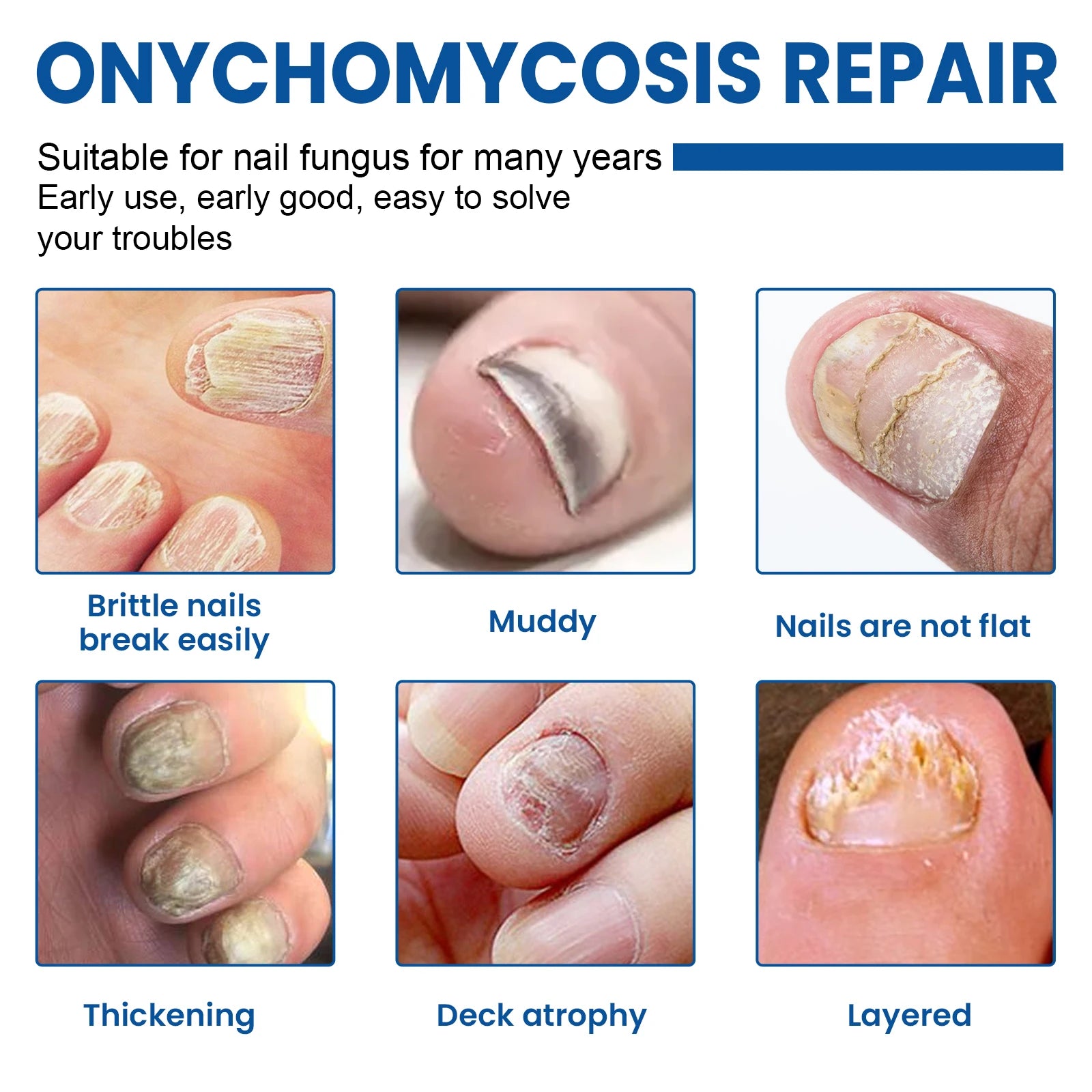 Nail Repair Patches Toenail Fungus Patch Sticky Toenail Care Nail Ingrown Correction Sticker Paronychia Nail Treatment Patch Oasis Select