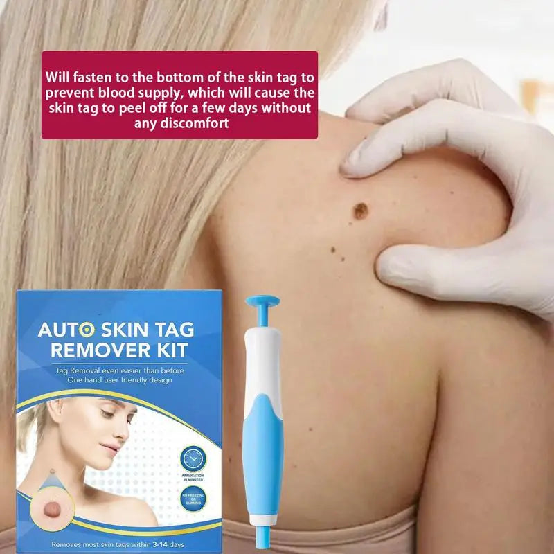 Skin Tag Removal Tool Face Beauty Accessories Skin Tag Removal Device Multipurpose Supplies for Face Neck Chin Back Oasis Select