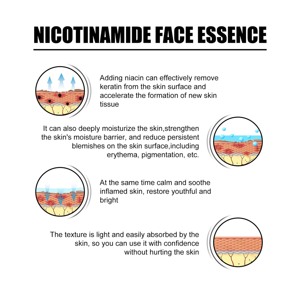 Eelhoe Niacinamide Face Serum – Fade Dark Spots & Brighten Skin Brightening Face Serum Oasis Select
