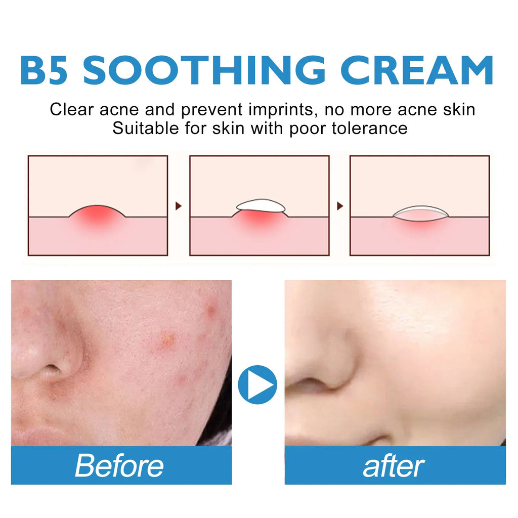 B5 Repair Cream Moisturizing Hydrating Soothing Dry Chapped Redness Skin Nourishes Hydrating Barrier Support Beauty Face Cream Oasis Select