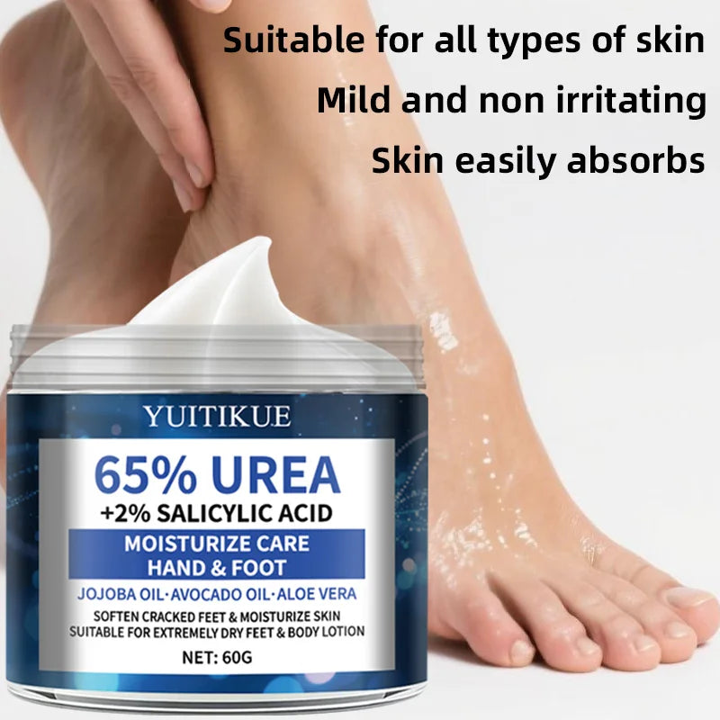 YUITIKUE 65% Urea Foot Cream – Cracked Heel Repair 60g