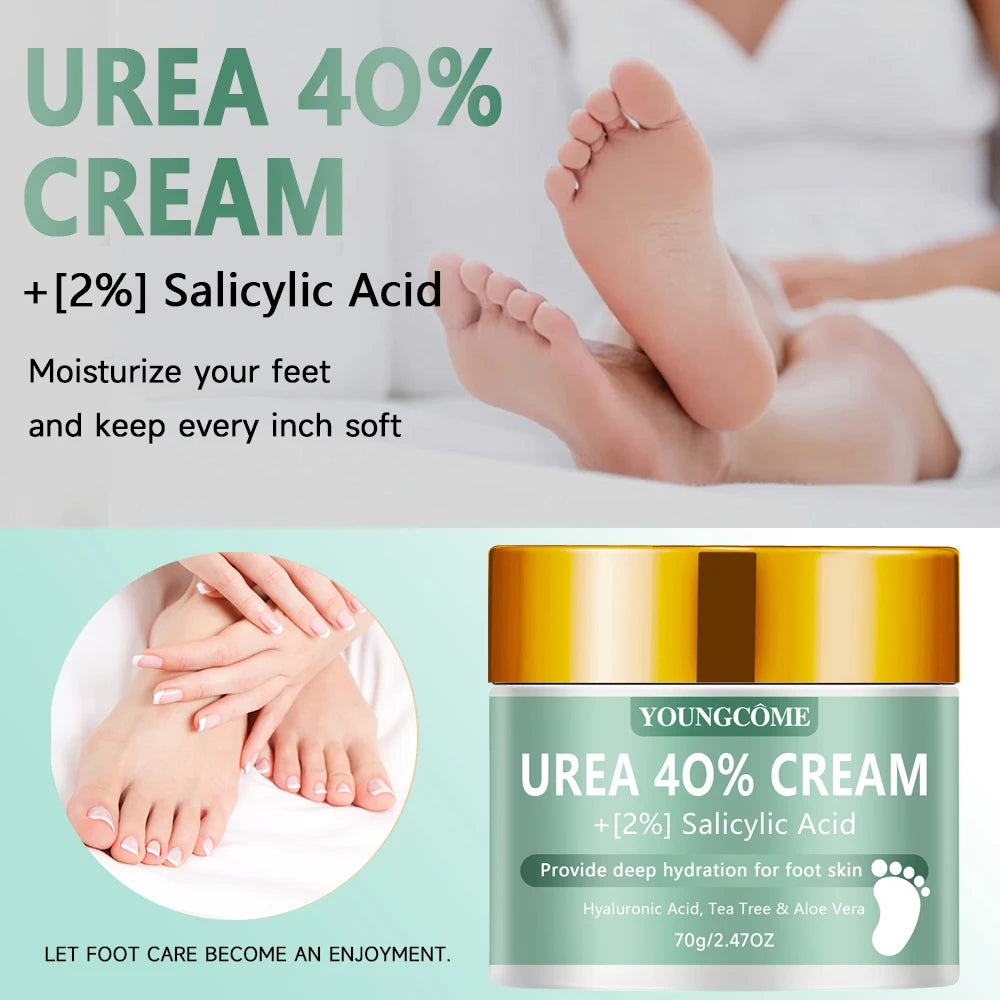 Urea 40% Foot & Hand Cream – Callus Softener | YOUNGCOME