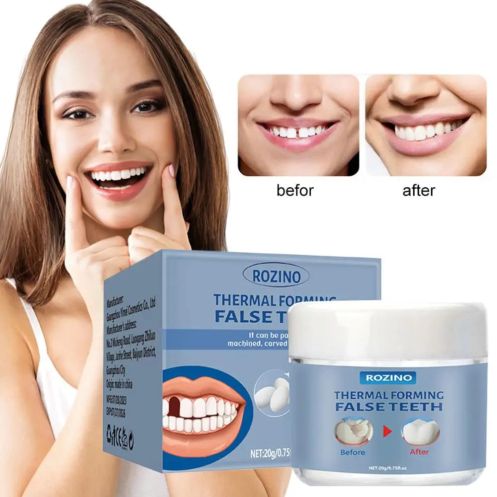 Moldable Tooth Repair Kit – Temporary Filling & False Teeth