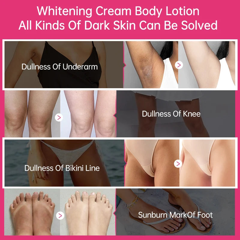 Collagen Whitening Cream Intimate Area Dark Skin Removeal Sensitive Areas Underarm Inner Thigh Lightening Body Cream Skin Care Oasis Select