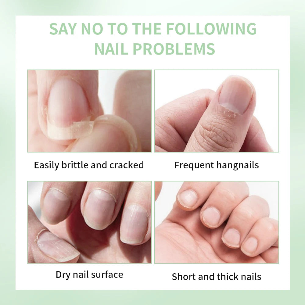Nail Growth & Nourishing Cuticle Oil – Strengthen Nails (3-Pack)