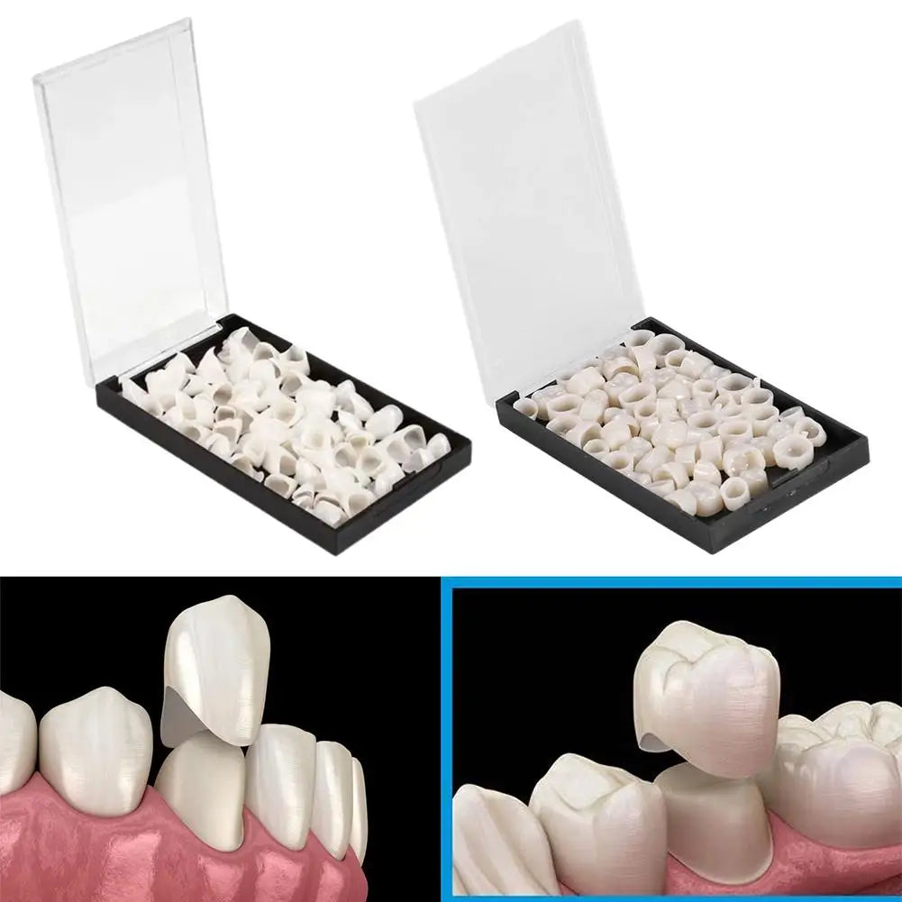 Temporary Dental Crowns Set 150pcs – Anterior & Posterior Temporary Dental Crowns Oasis Select