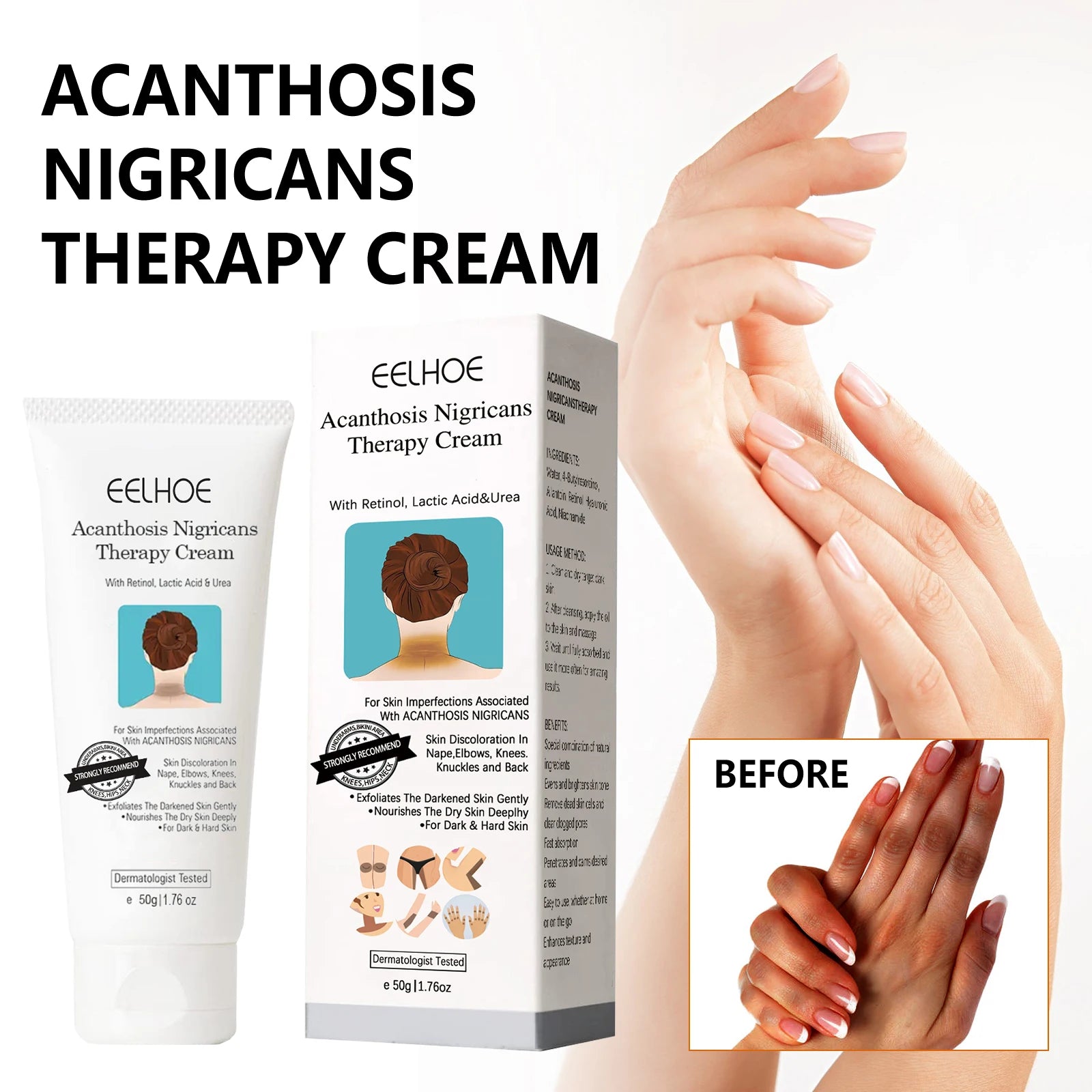 Acanthosis Nigricans Repair Cream – Dark Spot Brightening