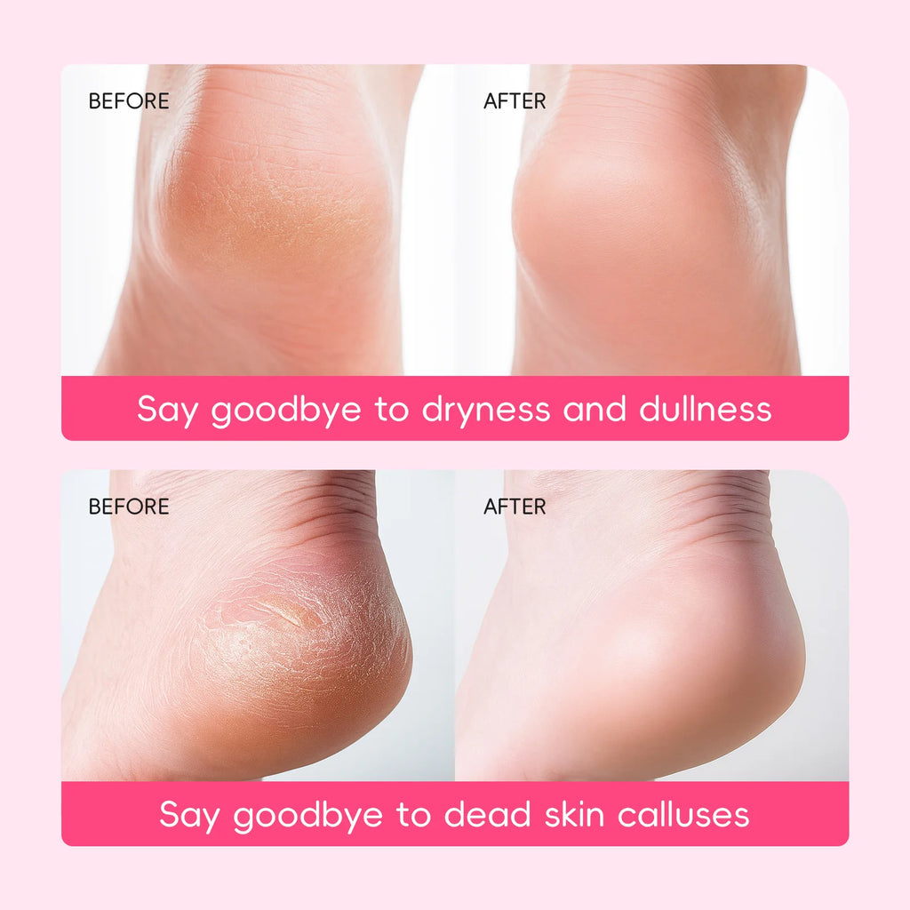 Japanese Cherry Blossom Foot Mask 40g Softening Callus Remover Dead Skin Peel Hydrating Nourishing Foot Care Dry Cracked Heel Oasis Select