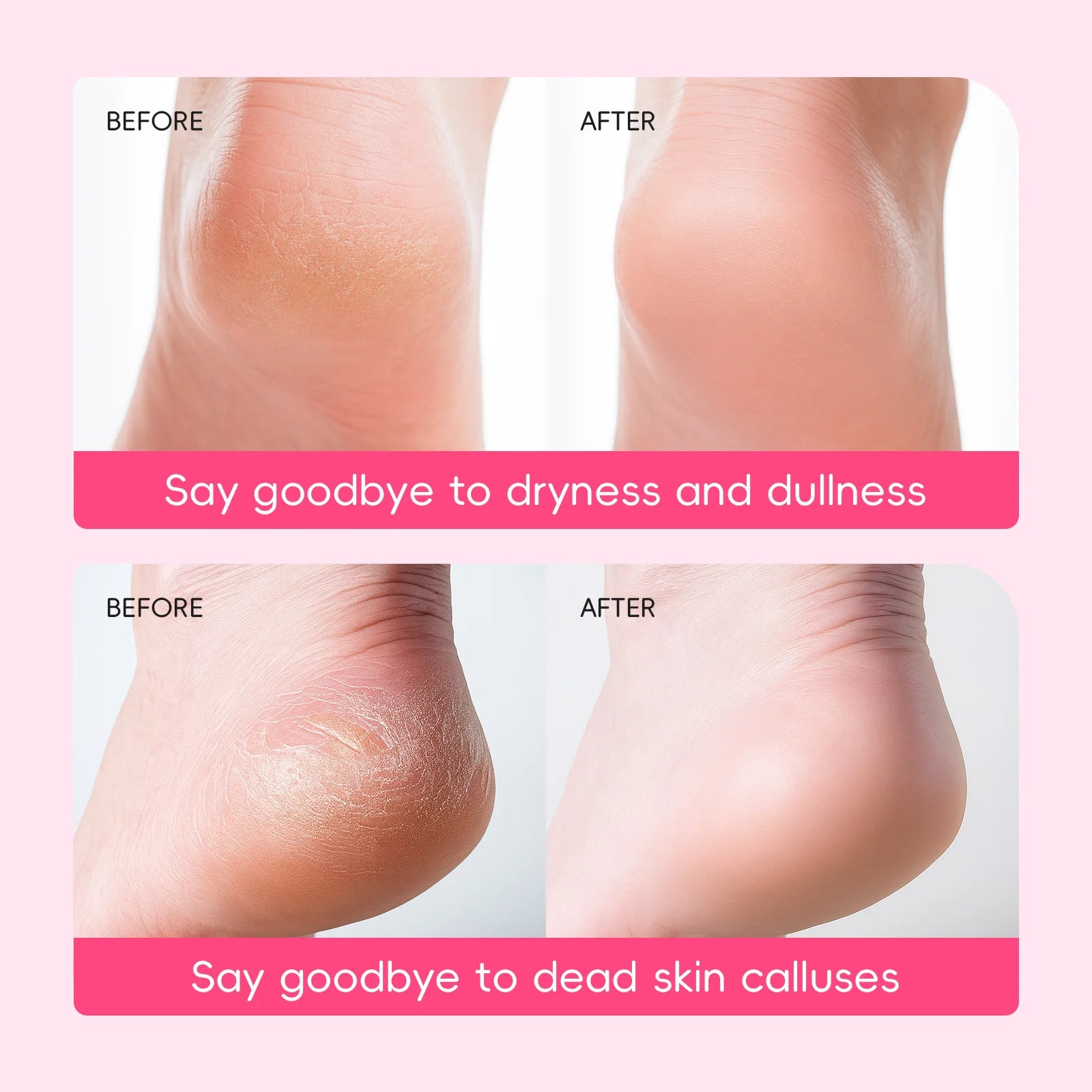 Japanese Cherry Blossom Foot Mask 40g Softening Callus Remover Dead Skin Peel Hydrating Nourishing Foot Care Dry Cracked Heel Oasis Select