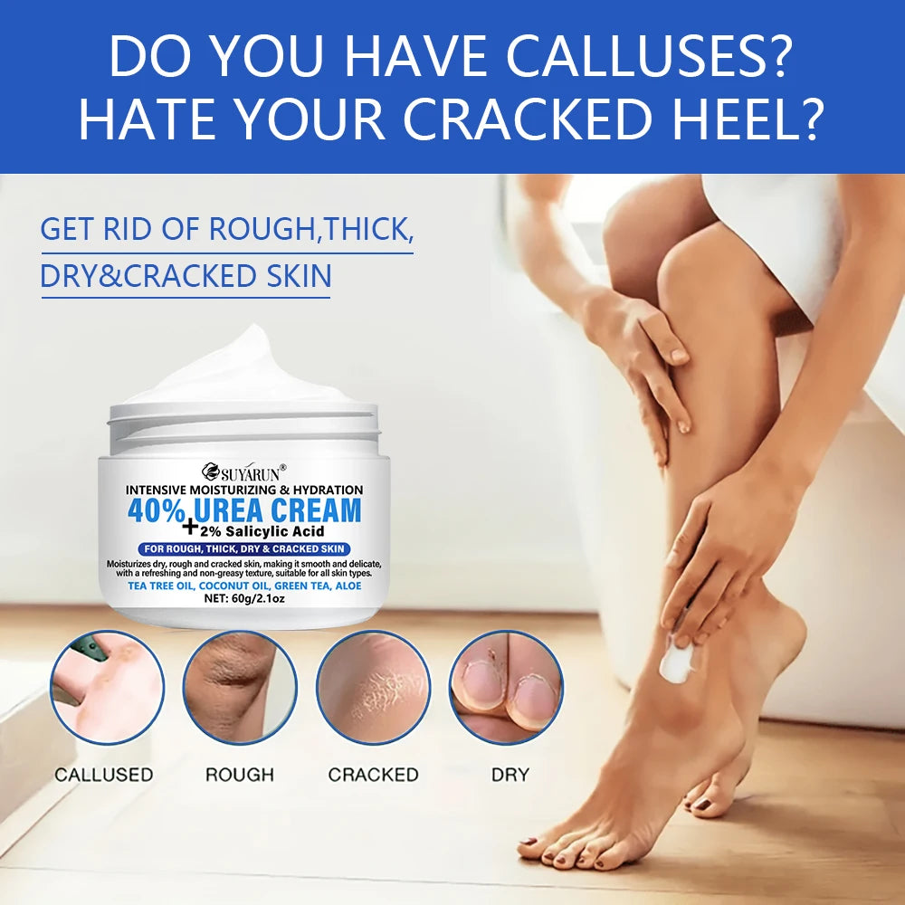 SUYARUN 40% Urea Foot Cream Stick - Moisturizing & Exfoliating, Cracked Heel Repair, Deep Hydration for Dry Feet, Long protect. Oasis Select