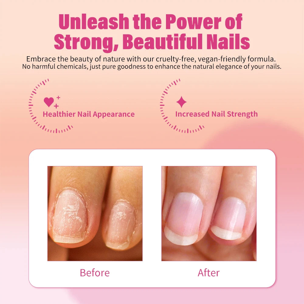 Nail Strengthener Cuticle Oil – Stop Splits, Chips & Cracks Nail Repair Treatment Oasis Select