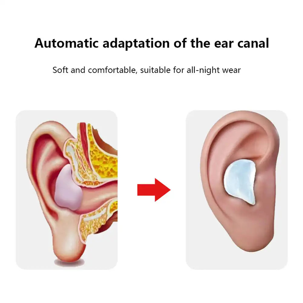 Silicone Reusable Earplugs – Noise Reduction, Sleep & Swimming
