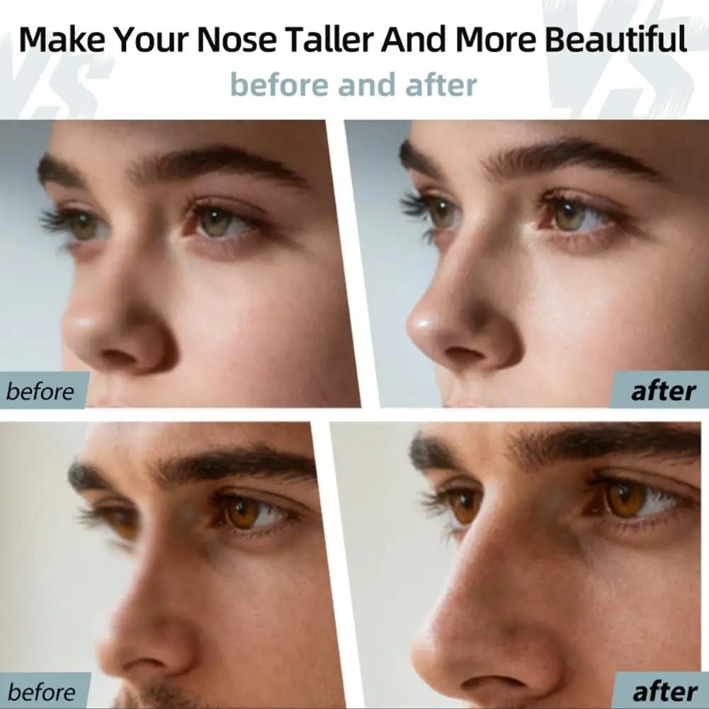 Nose Shaper For Wide Noses, Nose Shaper Up Lifting Clip, Pain Free Nose Slimmer Straightener Device Nose Lifter High Up Tool Oasis Select