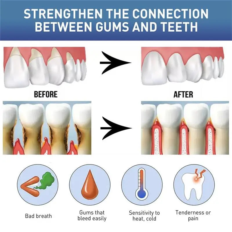 Gum Repair Care Gel Relieve Sore Gum Improve Gingival Damaged Inflammation Cleaning Teeth Stains Tartar Whitener Gum Protect Gel Oasis Select