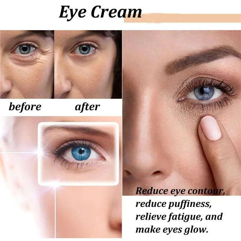 Retinol Eye Cream – Firming, Dark Circle & Hydrating 15ml Eye Cream Oasis Select