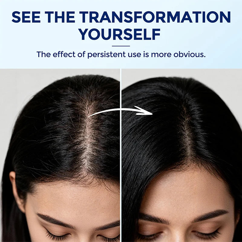 LEWEDO Rosemary Roll-On Hair Serum – Anti-Frizz & Oil Control
