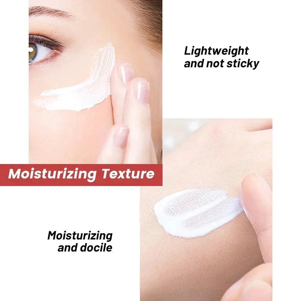 1/3/5pcs Whitening Freckle Cream Niacinamide Remove Dark Spot Cream Anti Freckle and Aging Cream Fade Pigmentation Melasma Skin Oasis Select