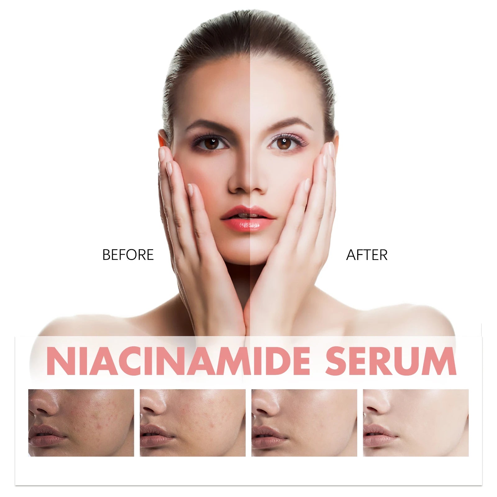 Peach Niacinamide Serum – Dark Spots, Pores & Brightening