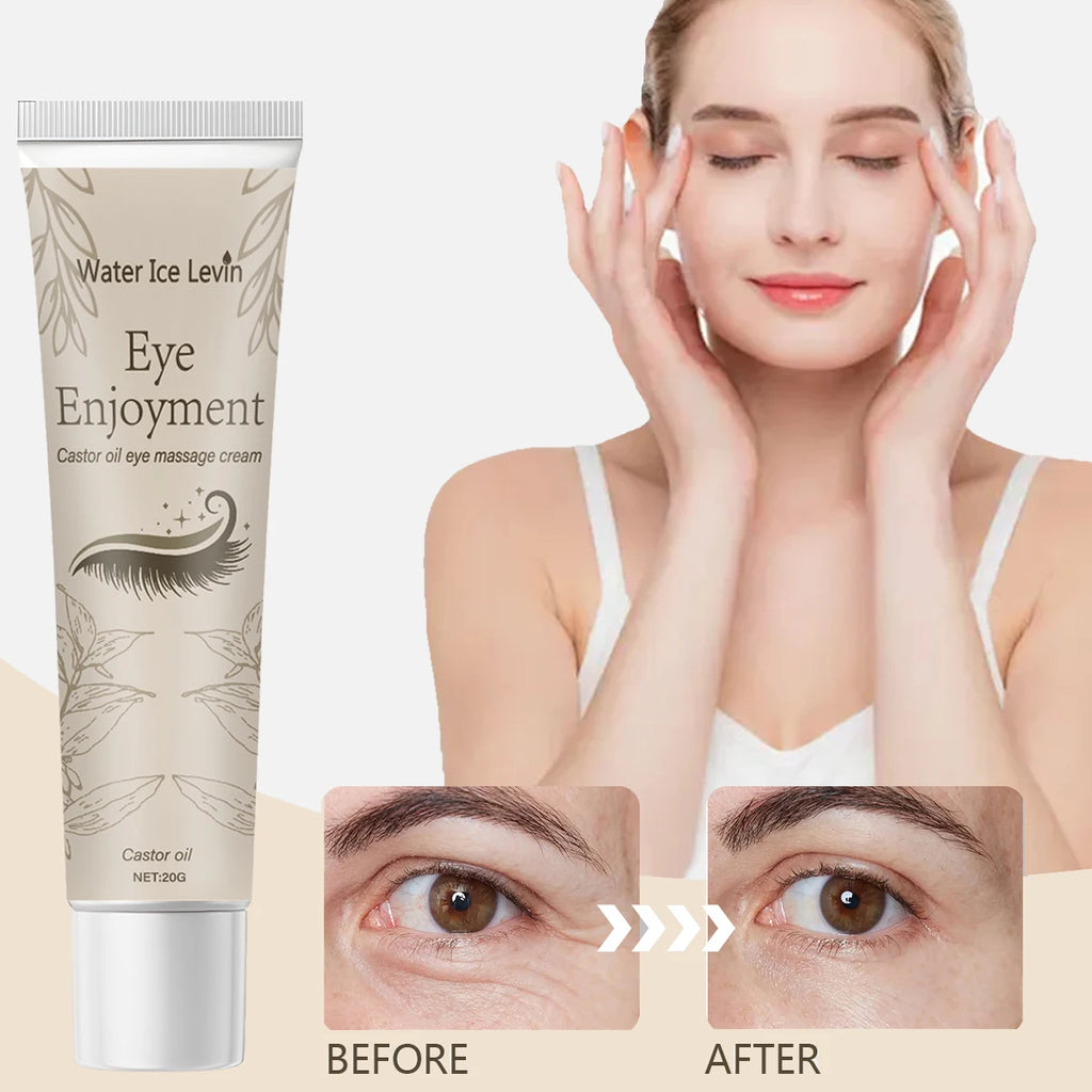 Castor Oil Eye Cream – Anti-Wrinkle, Dark Circles & Firming 20g Eye Treatment Cream Oasis Select