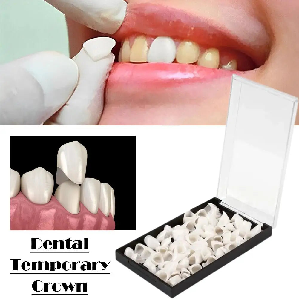 Temporary Dental Crowns Set 150pcs – Anterior & Posterior Temporary Dental Crowns Oasis Select