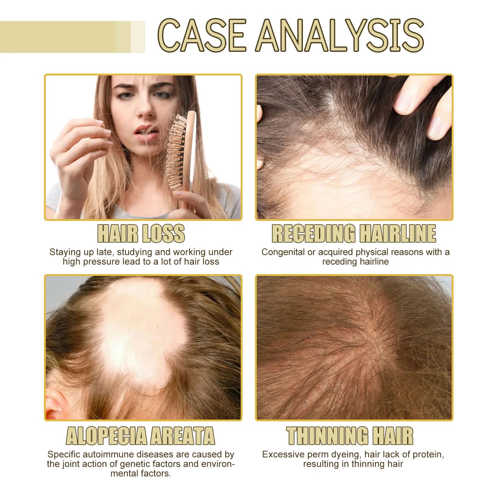 Jaysuing Rosemary Hair Growth Oil – Thicken & Strengthen 60ml Hair Growth Serum Oasis Select